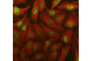 IF analysis of TDG using anti-TDG antibody (ABIN7600107) and anti-Tubulin Alpha antibody (ABIN7600339). (TDG Antikörper  (AA 15-370))