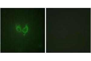 Immunofluorescence analysis of HuvEc cells, using MARK2 (Ab-596) Antibody. (MARK2 Antikörper  (AA 562-611))