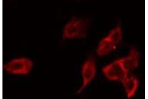 ABIN6266568 staining LOVO by IF/ICC.