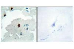 Immunohistochemistry analysis of paraffin-embedded human brain tissue using PTTG antibody. (PTTG1IP Antikörper  (C-Term))