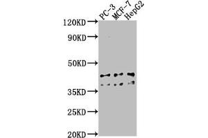 Western Blot Positive WB detected in: PC-3 whole cell lysate, MCF-7 whole cell lysate, HepG2 whole cell lysate All lanes: RHBDD3 antibody at 1:1000 Secondary Goat polyclonal to rabbit IgG at 1/50000 dilution Predicted band size: 41 kDa Observed band size: 41 kDa (RHBDD3 Antikörper  (AA 304-323))