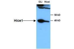 Anti-HICE1 in Western Blot using  Immunochemicals' Anti-HICE1 Antibody shows detection of a 45 kDa band corresponding to endogenous HICE1 in lysates of S phase HeLa cells silenced for either control Luciferase or HICE1. (NYS48/HAUS8 Antikörper)