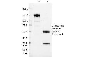SDS-PAGE Analysis Purified CD37 Mouse Monoclonal Antibody (IPO24). (CD37 Antikörper)