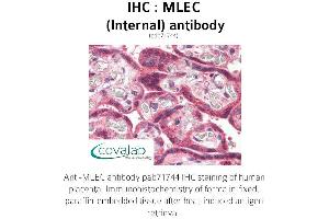 Image no. 1 for anti-Malectin (MLEC) (Internal Region) antibody (ABIN1736973)