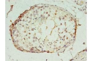 Immunohistochemistry of paraffin-embedded human testis tissue using ABIN7150442 at dilution of 1:100