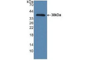 Western blot analysis of recombinant Human TBK1. (TBK1 Antikörper  (AA 9-310))