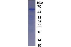 SDS-PAGE of Protein Standard from the Kit (Highly purified E. (Interleukin 35 ELISA Kit)