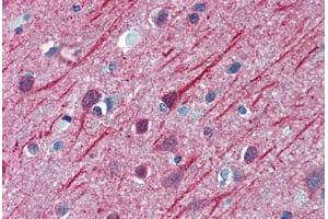 Human Brain, Cortex: Formalin-Fixed, Paraffin-Embedded (FFPE) (TUBB2A Antikörper  (AA 1-446))