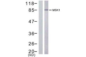 Western blot analysis of extract from HuVec cells treated or untreated with PMA (200nM, 30min), using MSK1 (Ab-376) antibody (E021198). (MSK1 Antikörper)