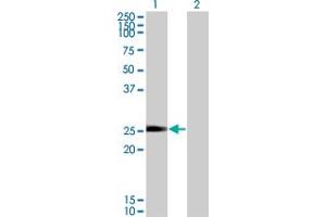 Western Blot analysis of NXNL1 expression in transfected 293T cell line by TXNL6 monoclonal antibody (M01), clone 7H3. (NXNL1 Antikörper  (AA 81-190))