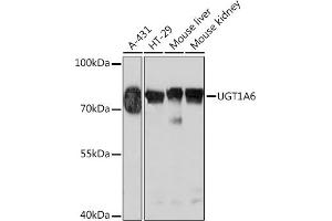 UGT1A6 Antikörper  (AA 65-270)