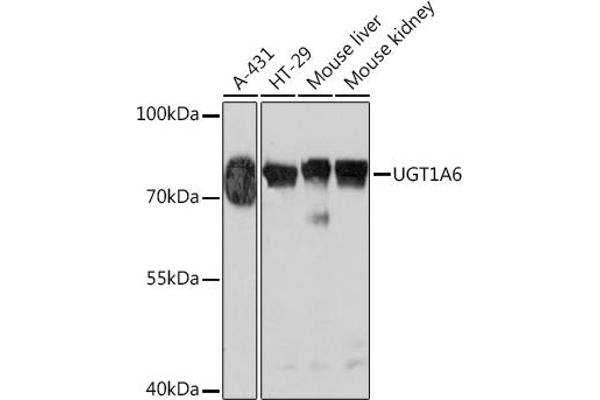 UGT1A6 Antikörper  (AA 65-270)