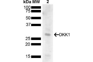 Western blot analysis of Human 293T showing detection of 28. (DKK1 Antikörper  (AA 120-220) (PE))