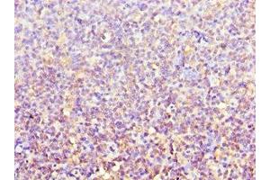 Immunohistochemistry of paraffin-embedded human tonsil tissue using ABIN7143106 at dilution of 1:100