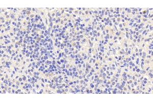 Detection of EMR1 in Human Spleen Tissue using Polyclonal Antibody to EGF Like Module Containing Mucin Like Hormone Receptor 1 (EMR1) (F4/80 Antikörper  (AA 1-201))