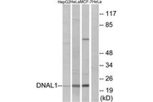 Western Blotting (WB) image for anti-Dynein, Axonemal, Light Chain 1 (DNAL1) (AA 121-170) antibody (ABIN2890280)