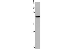Western Blotting (WB) image for anti-Acid Phosphatase 6, Lysophosphatidic (ACP6) antibody (ABIN2430391) (ACP6 Antikörper)