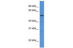 Western Blot showing HARS antibody used at a concentration of 1 ug/ml against 293T Cell Lysate (HARS1/Jo-1 Antikörper  (N-Term))