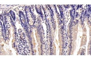 Immunohistochemistry (IHC) image for anti-Mucin 2, Oligomeric Mucus/gel-Forming (MUC2) (AA 27-110) antibody (ABIN7429040)