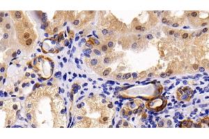 Detection of CK17 in Human Kidney Tissue using Polyclonal Antibody to Cytokeratin 17 (CK17) (KRT17 Antikörper  (AA 252-393))