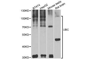 Western blot analysis of extracts of various cell lines, using UBC antibody. (UBC Antikörper  (AA 1-100))