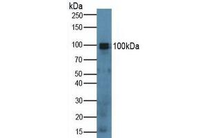 Detection of SPON1 in Mouse Lung Tissue using Polyclonal Antibody to Spondin 1 (SPON1) (SPON1 Antikörper  (AA 608-802))