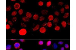 Immunofluorescence analysis of HeLa cells using BAZ1A Polyclonal Antibody at dilution of 1:100 (40x lens). (BAZ1A Antikörper)