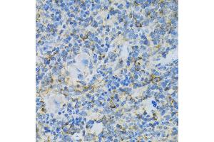 Immunohistochemistry of paraffin-embedded rat spleen using RPL13 antibody (ABIN1682571, ABIN5664631, ABIN5664633 and ABIN6220492) at dilution of 1:100 (40x lens). (RPL13 Antikörper  (AA 1-211))