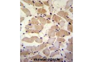 SUSD5 Antibody (C-term) immunohistochemistry analysis in formalin fixed and paraffin embedded human skeletal muscle followed by peroxidase conjugation of the secondary antibody and DAB staining. (SUSD5 Antikörper  (C-Term))