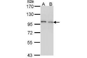 EPS8 抗体  (C-Term)