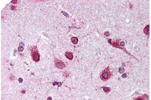 Human Brain, Cortex (formalin-fixed, paraffin-embedded) stained with PHB2 antibody ABIN239837 at 1:50 followed by biotinylated goat anti-rabbit IgG secondary antibody ABIN481713, alkaline phosphatase-streptavidin and chromogen. (Prohibitin 2 Antikörper  (C-Term))