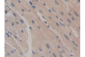 Immunohistochemistry (IHC) image for anti-Caspase 12 (Gene/pseudogene) (CASP12) (AA 1-413) antibody (ABIN7442993)