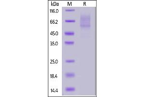 SDS-PAGE (SDS) image for Selectin P Ligand (SELPLG) (AA 42-320) protein (His tag,AVI tag,Biotin) (ABIN6973201)