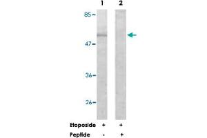 Western blot analysis of extracts from HeLa cells, treated with Etoposide (25 uM, 24 hours), using AKT1 polyclonal antibody . (AKT1 Antikörper)