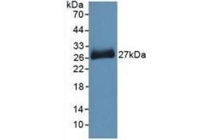 Detection of Recombinant PNOC, Mouse using Polyclonal Antibody to Pronociceptin (PNOC) (Pronociceptin (AA 12-187) Antikörper)