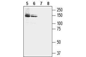 Western blot analysis of human LNCaP  prostate carcinoma (lanes 5 and 7) and MCF-7 breast adenocarcinoma (lanes 6 and 8) cell lysates: - 5,6. (NCAM2 Antikörper  (Extracellular, N-Term))