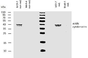 Western blotting analysis of human acidic cytokeratins using mouse monoclonal antibody AE1 on lysates of MCF-7 cell line and Molt-4 cell line (cytokeratin non-expressing cell line, negative control) under non-reducing and reducing conditions. (Keratin Acidic (AE1) Antikörper)