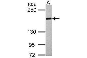 WB Image Sample (30 ug of whole cell lysate) A: HeLa 5% SDS PAGE antibody diluted at 1:1000 (UGCGL2 Antikörper)