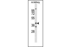 Western blot analysis ofFOXL1 / FKHL11 Antibody (Center) in mouse kidney tissue lysates (35ug/lane). (FOXL1 Antikörper  (Middle Region))