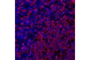 anti-HLA-DR (HLA-DR) antibody