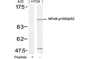 Image no. 3 for anti-Nuclear Factor of kappa Light Polypeptide Gene Enhancer in B-Cells 2 (NFKB2) (Ser871) antibody (ABIN197572) (NFKB2 Antikörper  (Ser871))