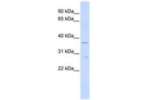 Image no. 1 for anti-Interferon gamma Receptor 2 (Interferon gamma Transducer 1) (IFNGR2) (AA 180-229) antibody (ABIN6740980) (IFNGR2 Antikörper  (AA 180-229))