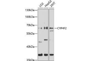 Western blot analysis of extracts of various cell lines, using CYP4F2 antibody (ABIN6130171, ABIN6139366, ABIN6139367 and ABIN6214266) at 1:1000 dilution. (CYP4F2 Antikörper  (AA 40-120))