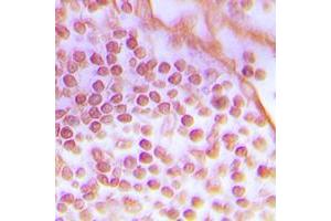 Immunohistochemical analysis of DNA-PKcs staining in human tonsil formalin fixed paraffin embedded tissue section. (PRKDC Antikörper  (C-Term))