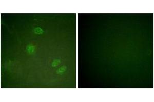 Immunofluorescence analysis of HeLa cells, using Elk3 (Ab-357) Antibody.