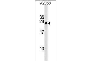 CYorf15B Antibody (Center) (ABIN1538521 and ABIN2849472) western blot analysis in  cell line lysates (35 μg/lane). (CYorf15B Antikörper  (AA 60-86))