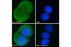 ABIN6391413 Immunofluorescence analysis of paraformaldehyde fixed MCF7 cells, permeabilized with 0. (PDGFB Antikörper  (C-Term))