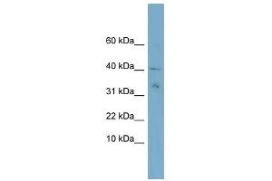 NDUFV3 antibody used at 1 ug/ml to detect target protein. (NDUFV3 Antikörper)