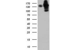 HEK293T cells were transfected with the pCMV6-ENTRY control (Left lane) or pCMV6-ENTRY HDAC6 (Right lane) cDNA for 48 hrs and lysed. (HDAC6 Antikörper)