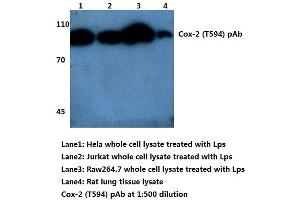 Western blot (WB) analysis of Cox2/PGHS2 (pThr594) antibody (PTGS2 Antikörper)